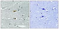 SPAK (phospho Ser309) Polyclonal Antibody