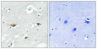 SPAK (phospho Ser323) Polyclonal Antibody