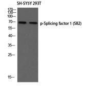 Splicing factor 1 (phospho Ser82) Polyclonal Antibody