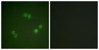 Splicing factor 1 (phospho Ser82) Polyclonal Antibody