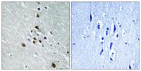 Splicing factor 1 (phospho Ser82) Polyclonal Antibody