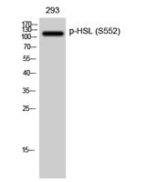 HSL (phospho Ser552) Polyclonal Antibody