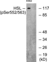 HSL (phospho Ser552) Polyclonal Antibody