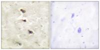 ALK (phospho Tyr1507) Polyclonal Antibody