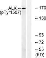 ALK (phospho Tyr1507) Polyclonal Antibody