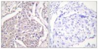 HSP20 (phospho Ser16) Polyclonal Antibody