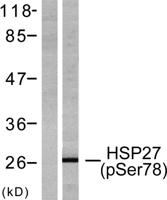 HSP27 (phospho Ser78) Polyclonal Antibody