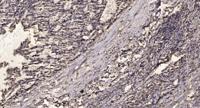 HSP27 (phospho Ser82) Polyclonal Antibody