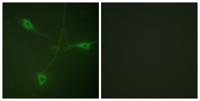 HSP90β (phospho Ser226) Polyclonal Antibody