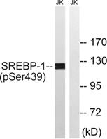 SREBP-1 (phospho Ser439) Polyclonal Antibody