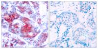 Stat4 (phospho Tyr693) Polyclonal Antibody