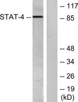 Stat4 (phospho Tyr693) Polyclonal Antibody