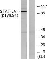 Stat5 (phospho Tyr694/699) Polyclonal Antibody