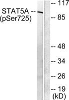 Stat5a/b (phospho Ser726/731) Polyclonal Antibody