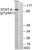 Stat6 (phospho Tyr641) Polyclonal Antibody