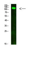 JAK2/3 (Phospho Tyr966/939) Antibody