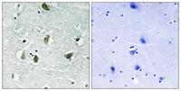 JAK2 (phospho Tyr931) Polyclonal Antibody