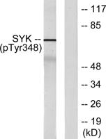 Syk (phospho Tyr348) Polyclonal Antibody