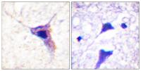 Synapsin I (phospho Ser62) Polyclonal Antibody