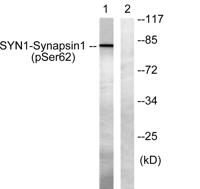 Synapsin I (phospho Ser62) Polyclonal Antibody