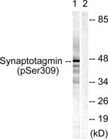 Synaptotagmin 1/2 (phospho Ser309/306) Polyclonal Antibody