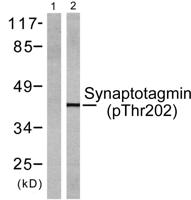 Synaptotagmin 1/2 (phospho Thr202/199) Polyclonal Antibody