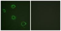 IFN-γRα (phospho Tyr457) Polyclonal Antibody