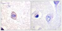 IFN-γRα (phospho Tyr457) Polyclonal Antibody