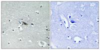 Syntaxin 1 (phospho Ser14) Polyclonal Antibody