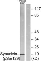 Synuclein-α (phospho Ser129) Polyclonal Antibody