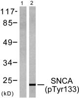 Synuclein-α (phospho Tyr133) Polyclonal Antibody