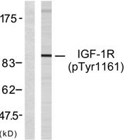 IGF-IR (phospho Tyr1161) Polyclonal Antibody