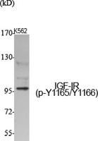 IGF-IR (phospho Tyr1165/Y1166) Polyclonal Antibody