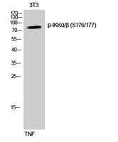 IKKα/β (phospho Ser176/177) Polyclonal Antibody