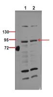 IKKα/β (phospho Ser176/177) Polyclonal Antibody