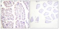 IKKα/β (phospho Ser180/181) Polyclonal Antibody