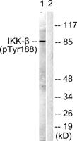 IKKβ (phospho Tyr188) Polyclonal Antibody