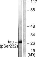 14-3-3 θ/τ (phospho Ser232) Polyclonal Antibody