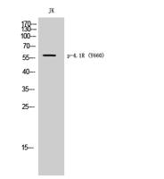 4.1R (phospho Tyr660) Polyclonal Antibody