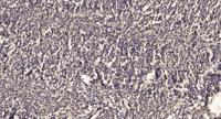 4.1R (phospho Tyr660) Polyclonal Antibody