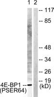 4E-BP1 (phospho Ser65) Polyclonal Antibody