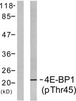 4E-BP1 (phospho Thr46) Polyclonal Antibody