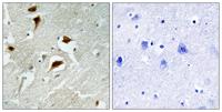 4E-BP1 (phospho Thr69) Polyclonal Antibody