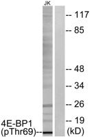 4E-BP1 (phospho Thr69) Polyclonal Antibody