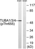 Tubulin α1/3/4 (phospho Tyr272) Polyclonal Antibody