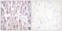 TRAP220 (phospho Thr1457) Polyclonal Antibody