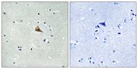 Trk A (phospho Tyr701) Polyclonal Antibody