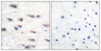 Trk A (phospho Tyr791) Polyclonal Antibody