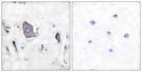 Trk B (phospho Tyr706) Polyclonal Antibody