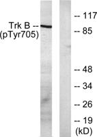 Trk B (phospho Tyr706) Polyclonal Antibody